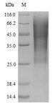 GLP1R / GLP-1 Receptor Protein - (Tris-Glycine gel) Discontinuous SDS-PAGE (reduced) with 5% enrichment gel and 15% separation gel. The reducing (R) protein migrates as 60 kDa in SDS-PAGE may be due to glycosylation.