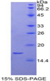 GP1BB / CD42c Protein - Recombinant Glycoprotein Ib Beta Polypeptide, Platelet By SDS-PAGE