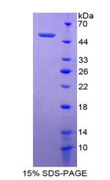 GP9 / CD42a Protein - Recombinant Glycoprotein IX, Platelet By SDS-PAGE