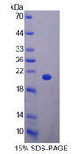 GP9 / CD42a Protein - Recombinant  Glycoprotein IX, Platelet By SDS-PAGE