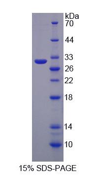 GPA33 / A33 Protein - Recombinant  Glycoprotein A33 By SDS-PAGE