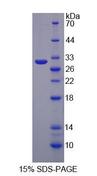 GPA33 / A33 Protein - Recombinant  Glycoprotein A33 By SDS-PAGE
