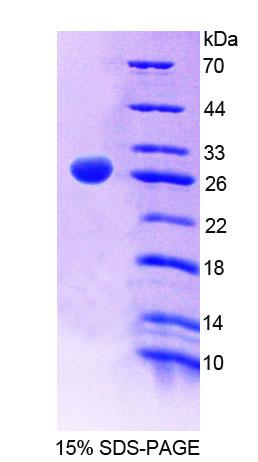 GPC5 / Glypican 5 Protein - Recombinant Glypican 5 (GPC5) by SDS-PAGE