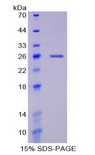 GPI Protein - Recombinant Glucose 6 Phosphate Isomerase By SDS-PAGE