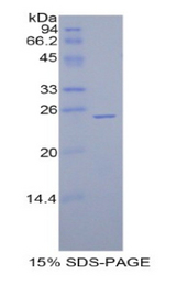 GPX5 Protein - Recombinant Glutathione Peroxidase 5 By SDS-PAGE