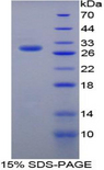 Growth Hormone Receptor / GHR Protein - Recombinant Growth Hormone Receptor By SDS-PAGE