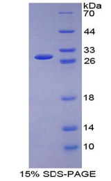 GSR / Glutathione Reductase Protein - Recombinant Glutathione Reductase By SDS-PAGE