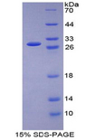GSR / Glutathione Reductase Protein - Recombinant Glutathione Reductase By SDS-PAGE