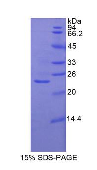 GSS / Glutathione Synthetase Protein - Recombinant Glutathione Synthetase By SDS-PAGE