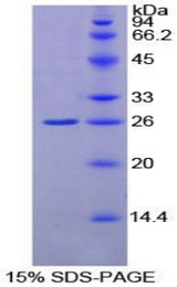 GSTK1 Protein - Recombinant Glutathione S Transferase Kappa 1 By SDS-PAGE