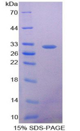 GSTT1 Protein - Recombinant Glutathione S Transferase Theta 1 By SDS-PAGE