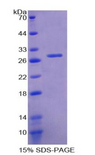 GSTT2 Protein - Recombinant Glutathione S Transferase Theta 2 By SDS-PAGE