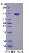 GTF3A Protein - Recombinant General Transcription Factor IIIA (GTF3A) by SDS-PAGE