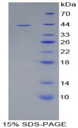 GYPC / Glycophorin C Protein - Recombinant Glycophorin C By SDS-PAGE