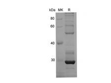 GZMM / Granzyme M Protein - Recombinant Rat DNMT1 Protein (His Tag)-Elabscience