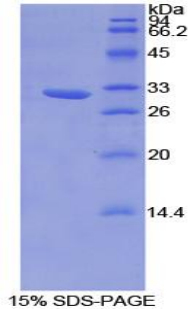 HAO1 Protein - Recombinant Hydroxyacid Oxidase 1 By SDS-PAGE