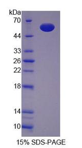 HAP1 Protein - Recombinant Huntingtin Associated Protein 1 By SDS-PAGE