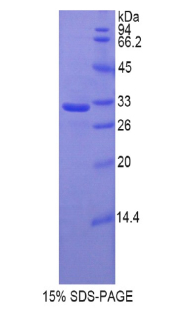 HAS1 / HAS Protein - Recombinant Hyaluronan Synthase 1 By SDS-PAGE