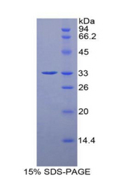 HDC / Histidine Decarboxylase Protein - Recombinant Histidine Decarboxylase By SDS-PAGE