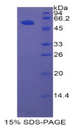 HGFAC / HGFA Protein - Recombinant Hepatocyte Growth Factor Activator By SDS-PAGE