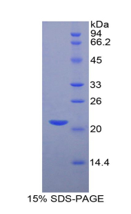 HIF1A / HIF1 Alpha Protein - Recombinant Hypoxia Inducible Factor 1 Alpha By SDS-PAGE