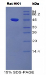 HK1 / Hexokinase 1 Protein - Recombinant Hexokinase 1 By SDS-PAGE