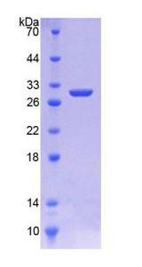 HMG-CoA Reductase / HMGCR Protein - Recombinant  3-Hydroxy-3-Methylglutaryl Coenzyme A Reductase By SDS-PAGE