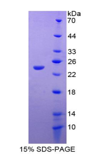 HMG1 / HMGB1 Protein