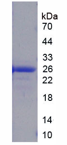 HMGB3 Protein - Recombinant High Mobility Group Box Protein 3 (HMGB3) by SDS-PAGE