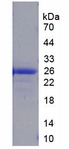 HMGB3 Protein - Recombinant High Mobility Group Box Protein 3 (HMGB3) by SDS-PAGE
