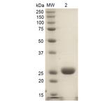 HMOX1 / HO-1 Protein - SDS-PAGE of ~32 kDa rat HO-1 protein.