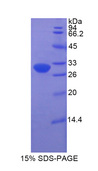 HP / Haptoglobin Protein - Recombinant  Haptoglobin Related Protein By SDS-PAGE