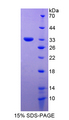 HP / Haptoglobin Protein - Recombinant  Haptoglobin By SDS-PAGE