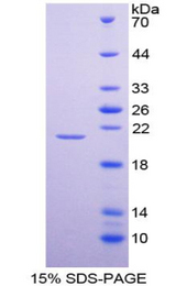 HPSE / Heparanase Protein - Recombinant  Heparanase By SDS-PAGE