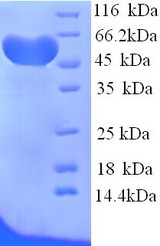 HPX / Hemopexin Protein