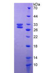 HSF2 Protein - Recombinant Heat Shock Transcription Factor 2 By SDS-PAGE