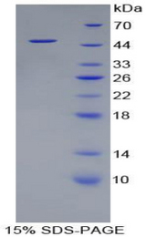 I-BABP / FABP6 Protein - Recombinant Fatty Acid Binding Protein 6, Ileal By SDS-PAGE