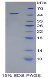 I-BABP / FABP6 Protein - Recombinant Fatty Acid Binding Protein 6, Ileal By SDS-PAGE