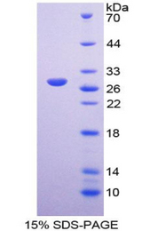 ICAM2 / CD102 Protein - Recombinant Intercellular Adhesion Molecule 2 By SDS-PAGE