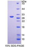 ICAM2 / CD102 Protein - Recombinant Intercellular Adhesion Molecule 2 By SDS-PAGE