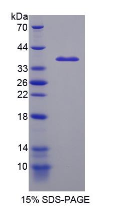 ICK Protein - Recombinant Intestinal Cell Kinase By SDS-PAGE