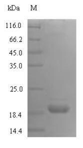 ICOS / CD278 Protein - (Tris-Glycine gel) Discontinuous SDS-PAGE (reduced) with 5% enrichment gel and 15% separation gel.