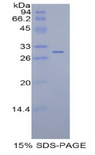 IDH1 / IDH Protein - Recombinant Isocitrate Dehydrogenase 1, Soluble By SDS-PAGE