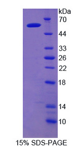 IDS / Iduronate 2 Sulfatase Protein - Recombinant Iduronate-2-Sulfatase By SDS-PAGE