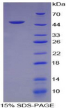 IFN Gamma / Interferon Gamma Protein - Recombinant Interferon Gamma By SDS-PAGE