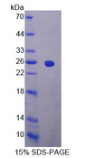 IFNA2 / Interferon Alpha 2 Protein - Recombinant  Interferon Alpha 2 By SDS-PAGE