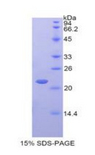 IFNA4 / Interferon Alpha 4 Protein - Recombinant Interferon Alpha 4 By SDS-PAGE