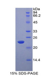 IFNA5 / Interferon Alpha 5 Protein - Recombinant Interferon Alpha 5 By SDS-PAGE