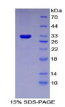 IFNAR1 / IFNAR Protein - Recombinant Interferon Alpha/Beta Receptor 1 By SDS-PAGE