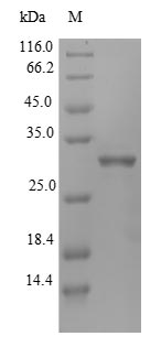 IGFBP1 Protein - (Tris-Glycine gel) Discontinuous SDS-PAGE (reduced) with 5% enrichment gel and 15% separation gel.